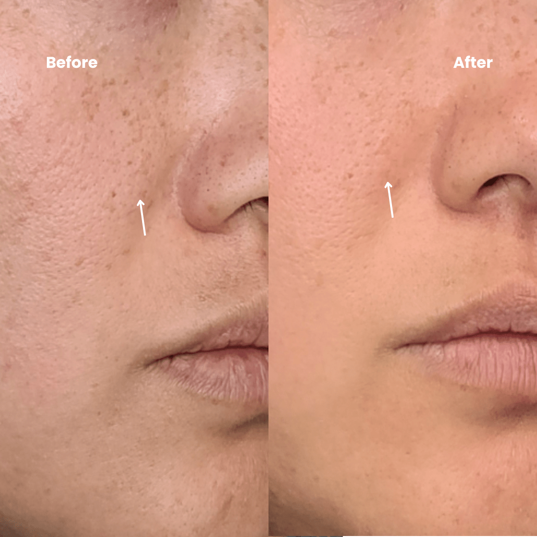 30 DAY NOURISHED NEW SKIN CELLS - All Skin Types ANTI - AGING Routine - DermoHelp Skin Care Products - Shop Now