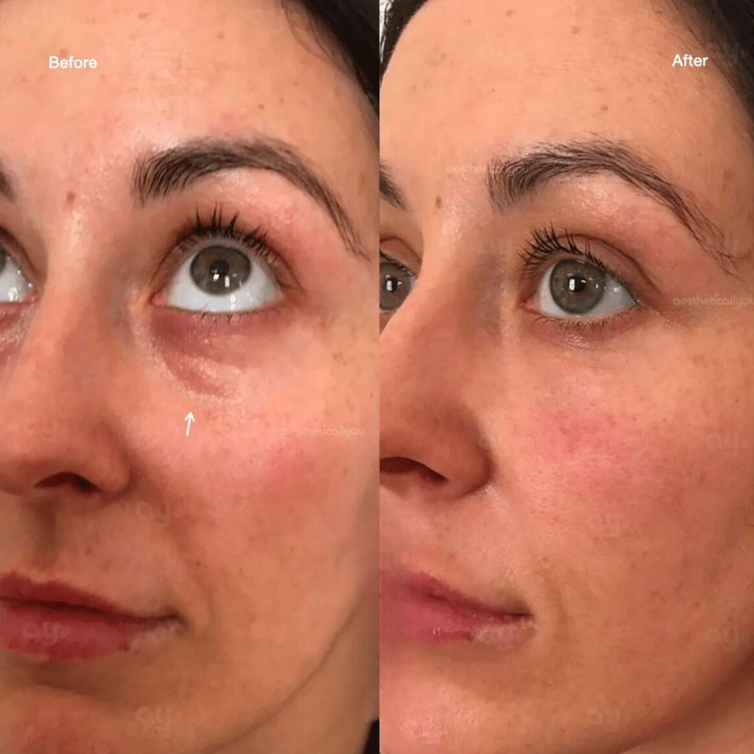 30 DAY NOURISHED NEW SKIN CELLS - All Skin Types ANTI - AGING Routine - DermoHelp Skin Care Products - Shop Now